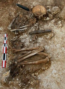 Stone Age burial with remains of amputee 