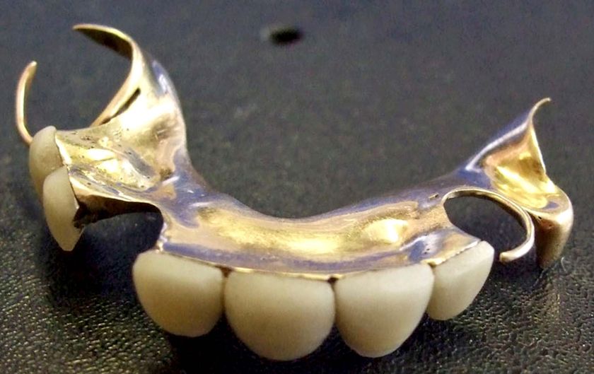 Churchill's $24,000 dentures