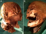 Mummified head of Henry IV