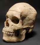 Atai's skull