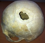 Skull from Bikeh III, male 50-60 years old, 5th–4th centuries B.C.