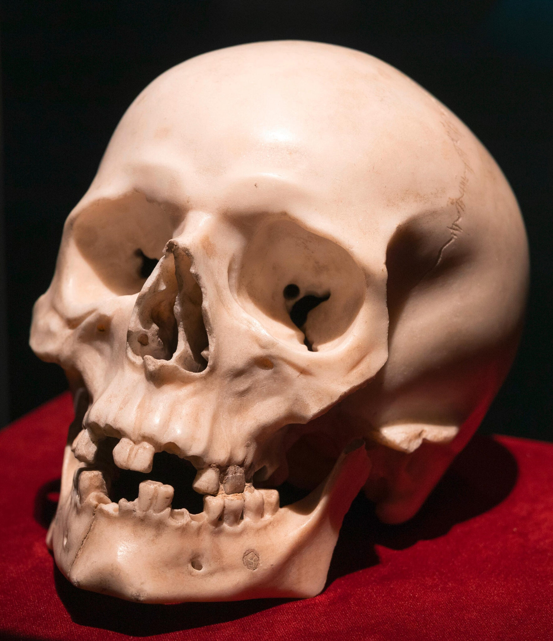 Forensic anthropological analysis done on Bernini marble skull