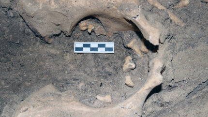 Oldest archaeological teratoma found in New Kingdom burial